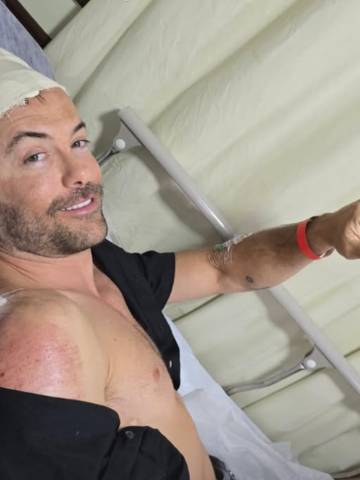 Kayky Brito sofre acidente de bicicleta